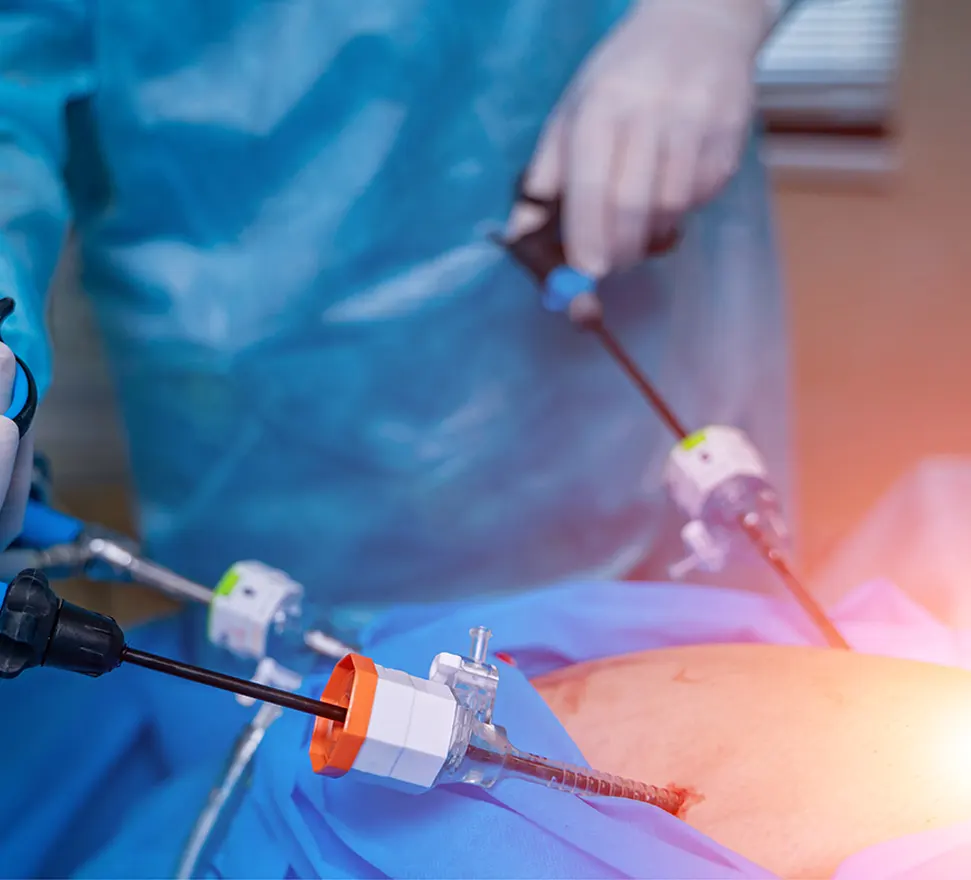 prix-chirurgie-bariatrique-tunisie prix-chirurgie-bariatrique-tunisie