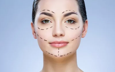Tout ce qu’il y a à savoir au sujet du lipofilling du visage